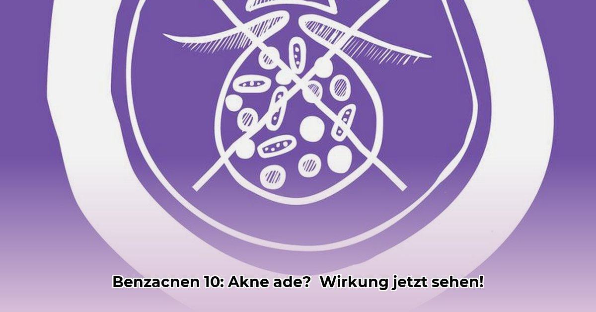 benzaknen-10